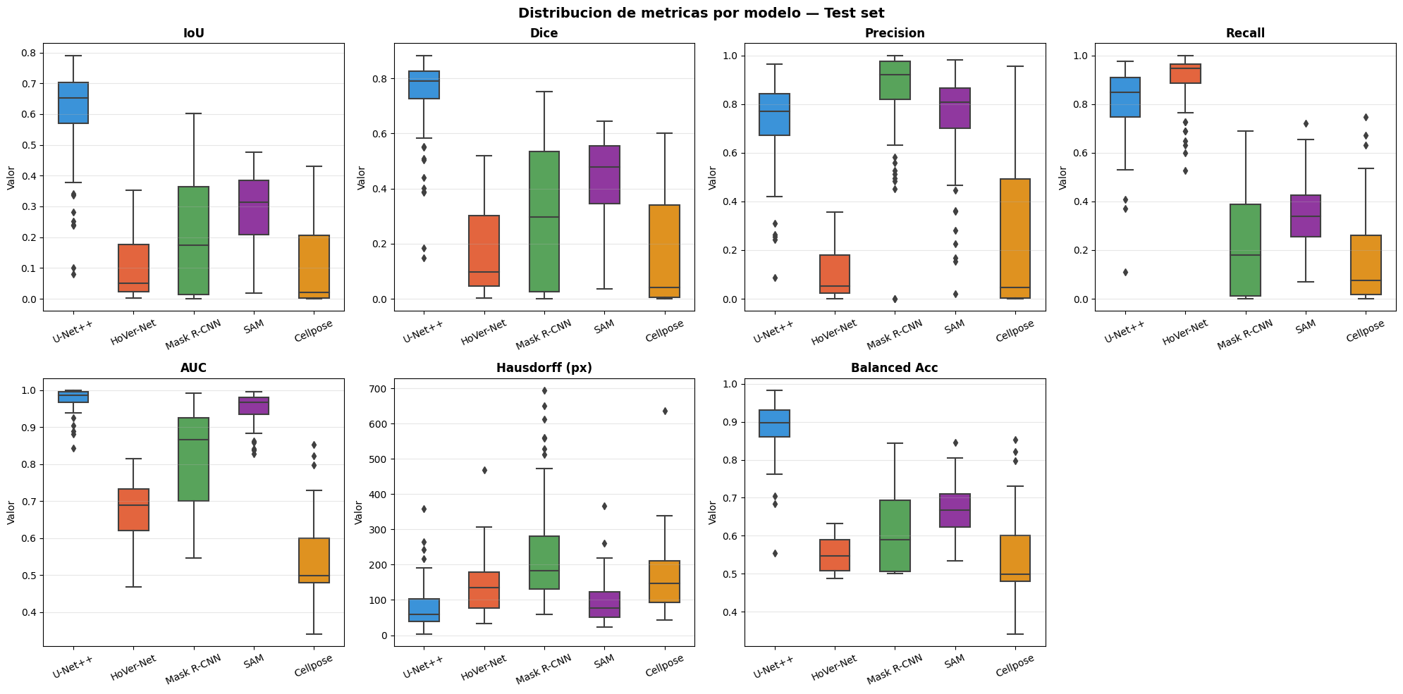 Evaluación Final — Sartorius Cell Instance Segmentation — Deep Learning ...