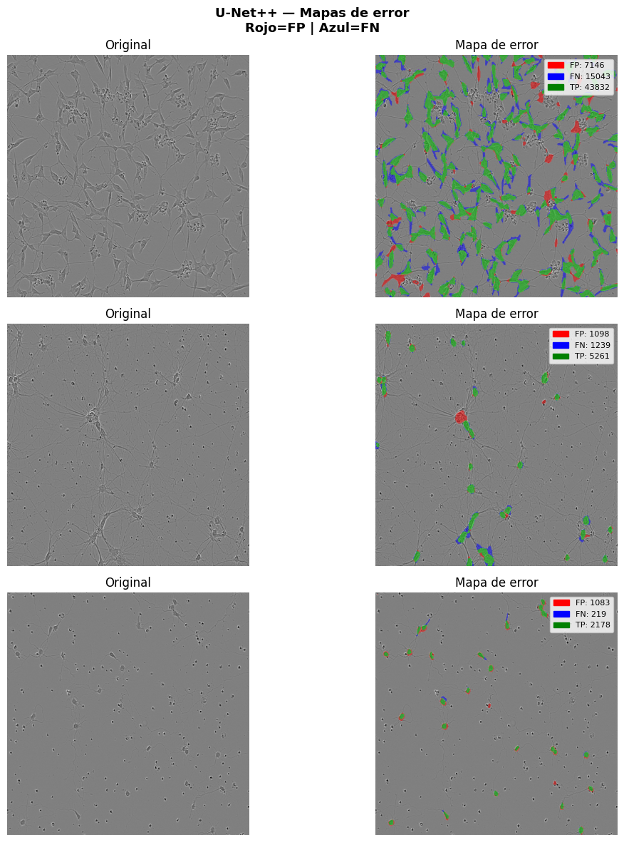 Evaluación Final — Sartorius Cell Instance Segmentation — Deep Learning ...
