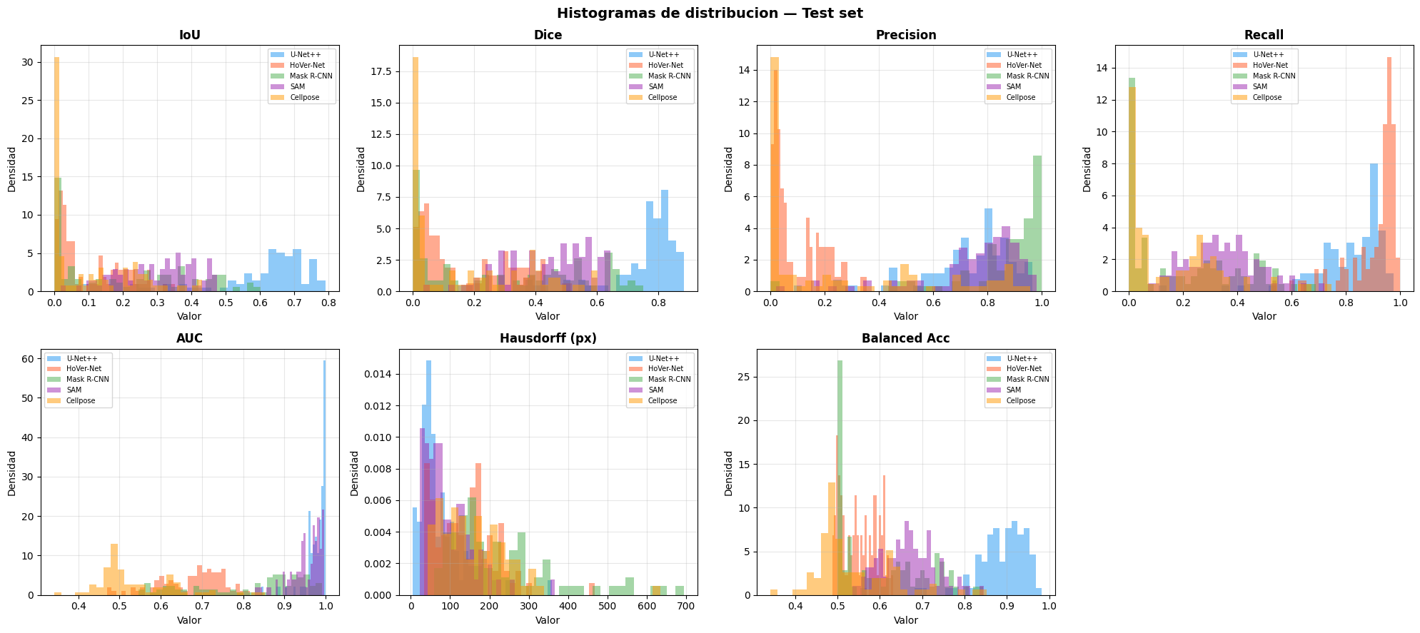 Evaluación Final — Sartorius Cell Instance Segmentation — Deep Learning ...