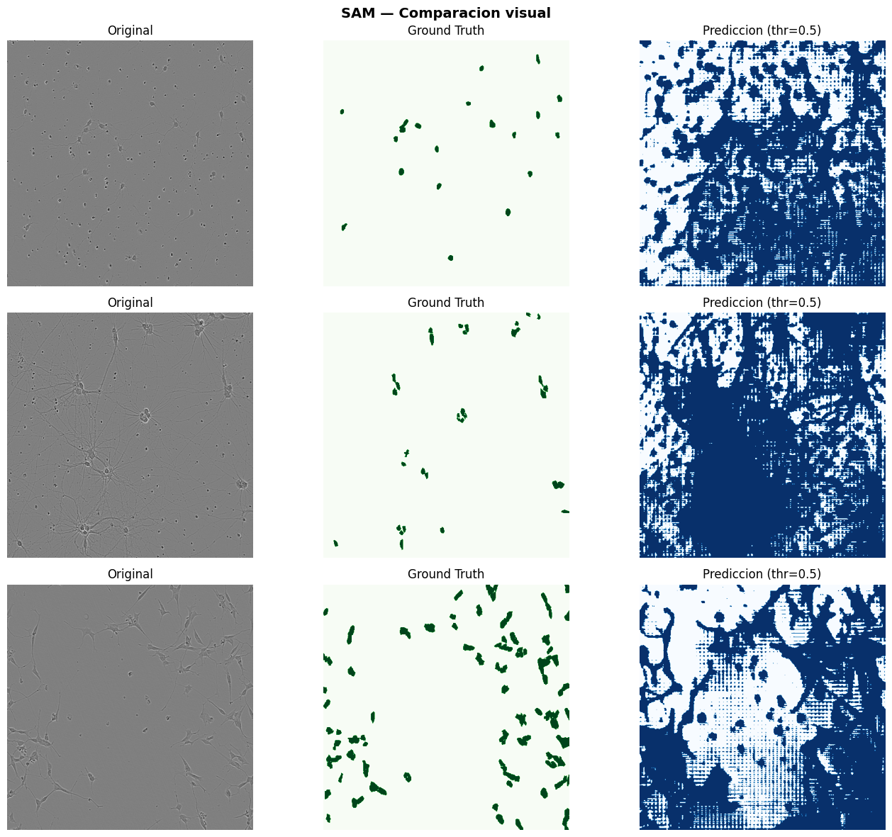 Evaluación Final — Sartorius Cell Instance Segmentation — Deep Learning ...