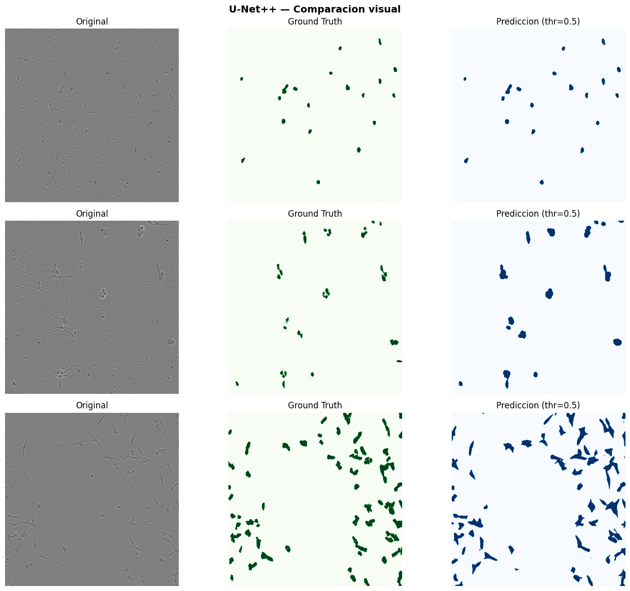 Evaluación Final — Sartorius Cell Instance Segmentation — Deep Learning ...